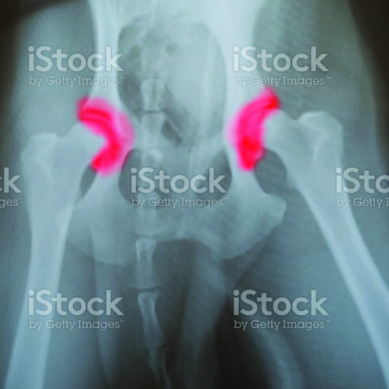 radiographie dysplasie